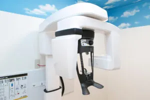 歯科用CT